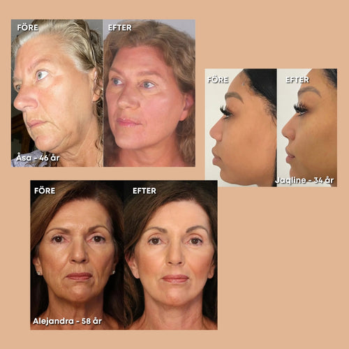 PureLift - Massageborste